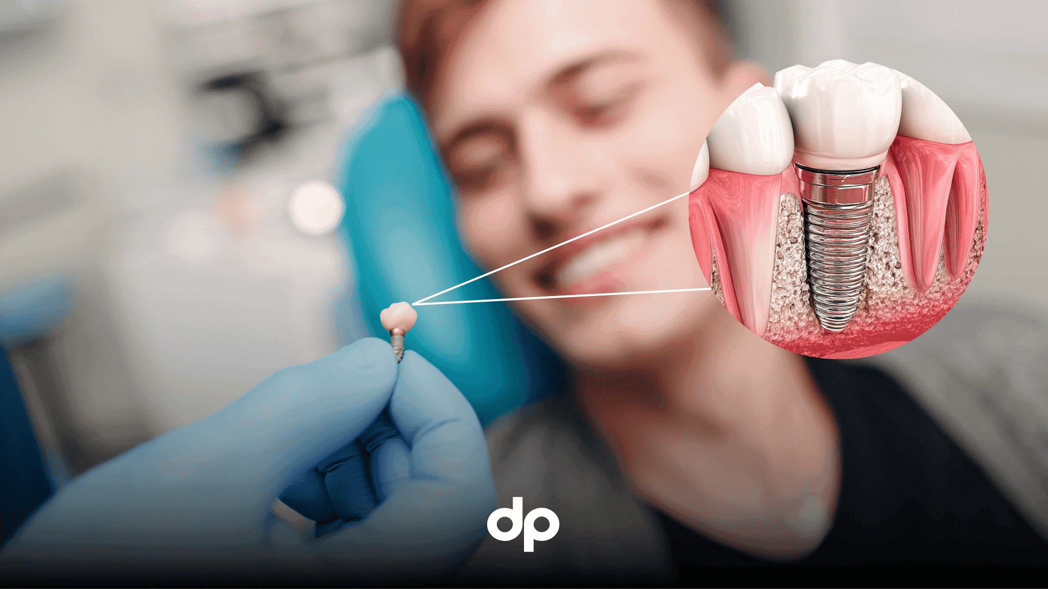 implant fiyatları