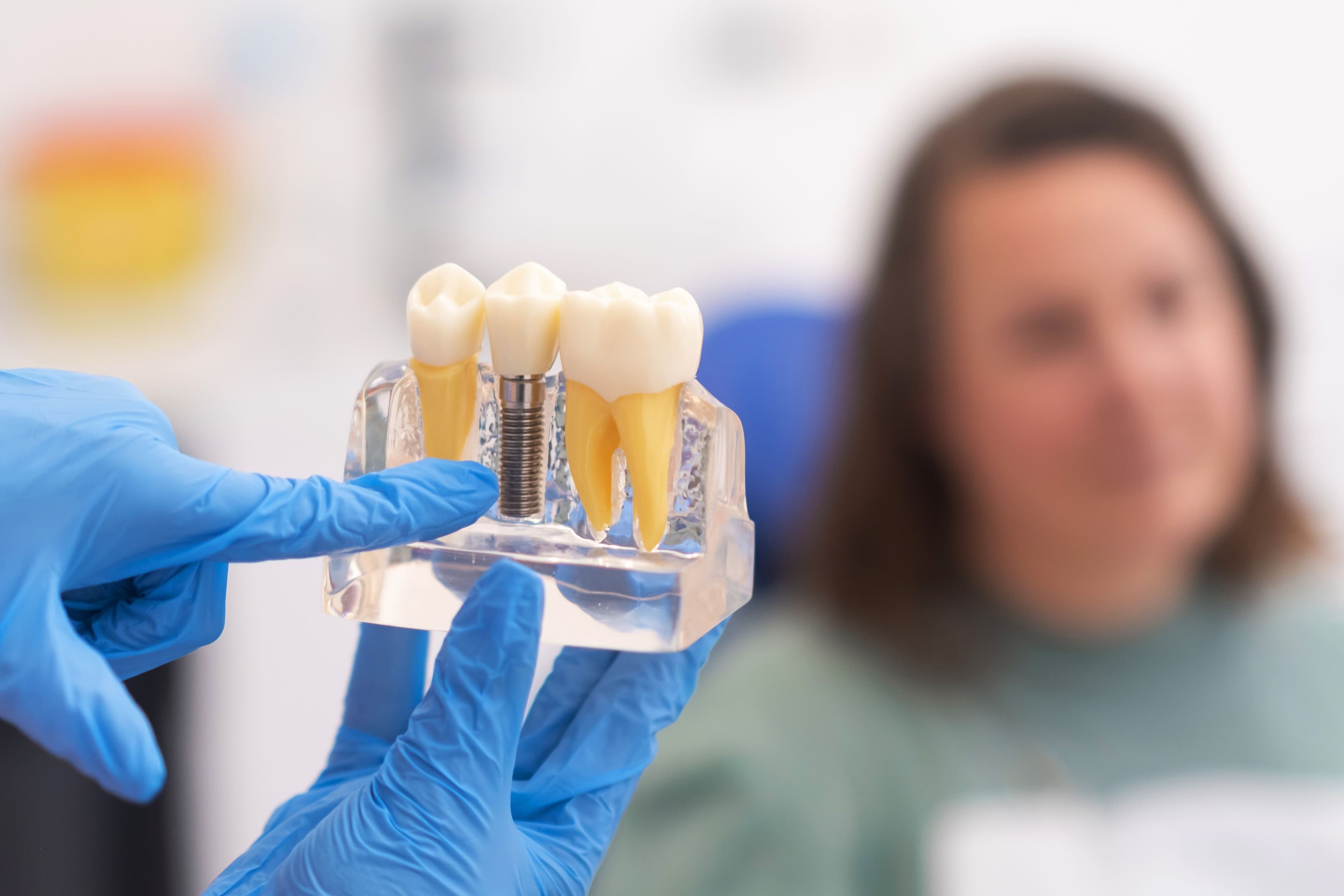 Dental Implant Treatment