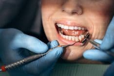 Filling Treatment Prices.jpg