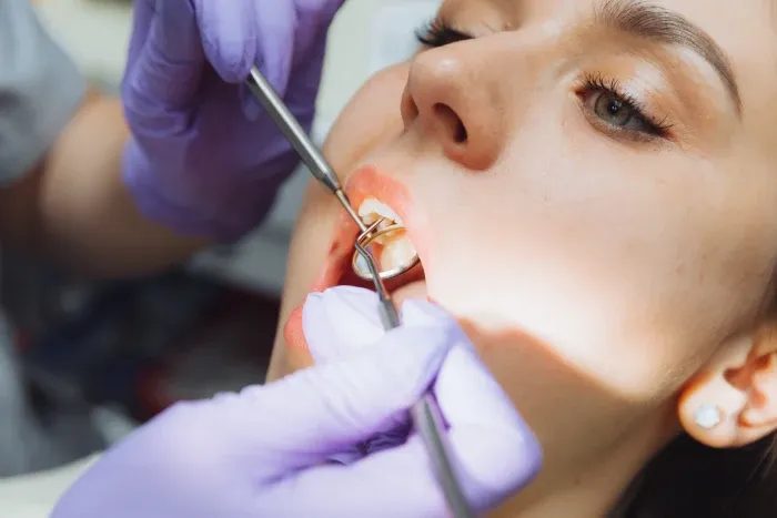 What Are Bone Grafts