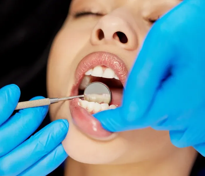 Lingual Orthodontics