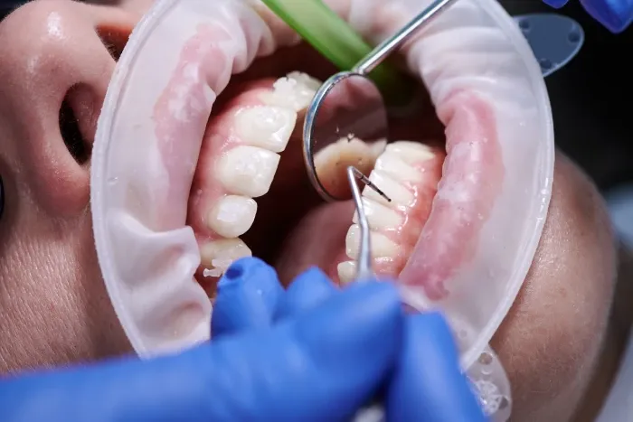 Periodontoloji Nedir