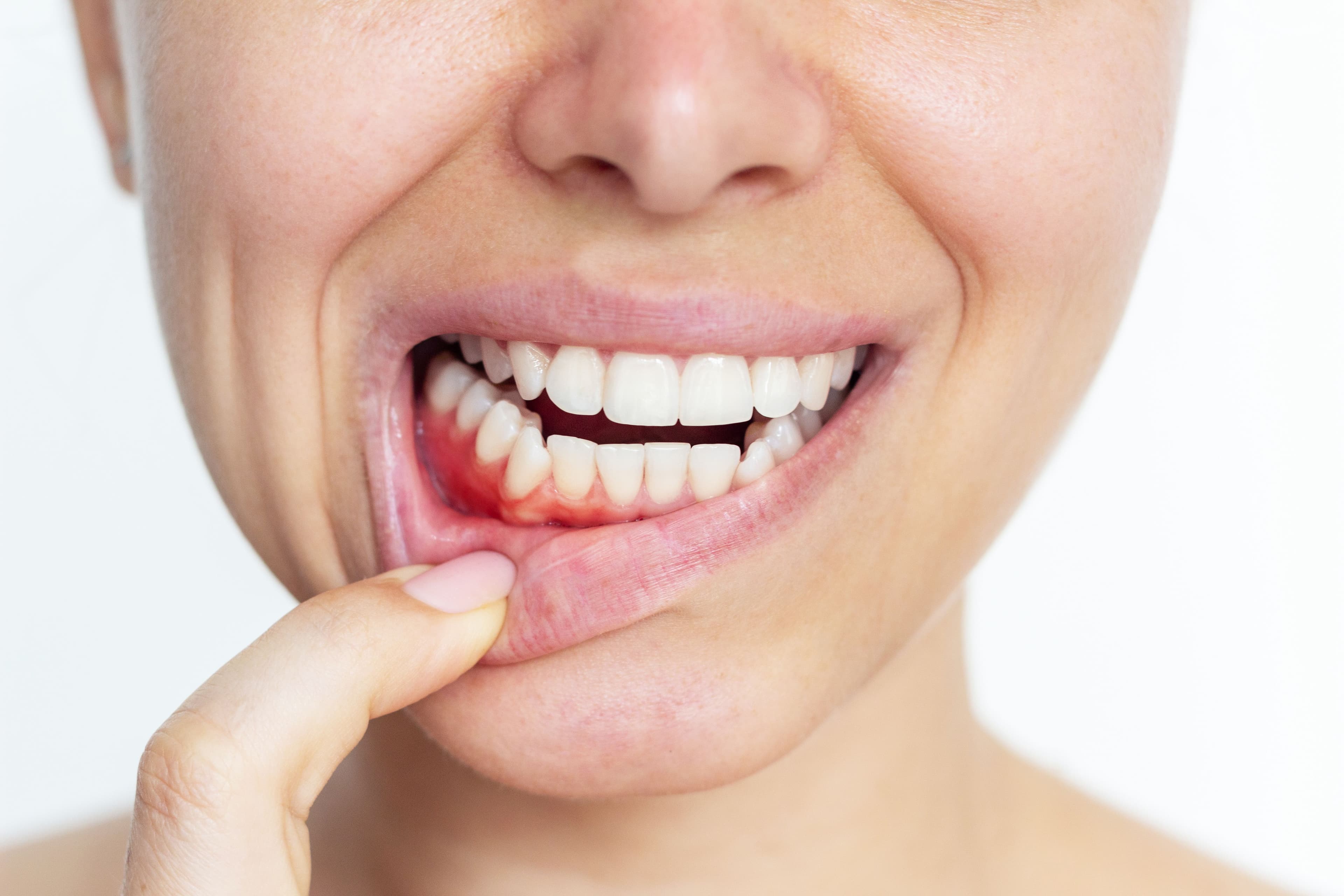 What is Gum Treatment?
