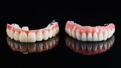 Acrylic Denture Prices Full and Partial Denture Fees.jpg