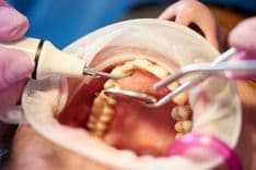 Dental Hygiene Guide: Everything You Need to Know