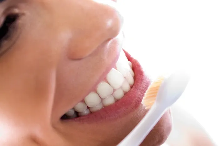 Front Tooth Aesthetic Filling Durability and Maintenance Recommendations.webp