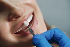 Laminated Tooth Treatment and Prices.jpg