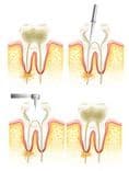 Root Canal Treatment Prices.jpg