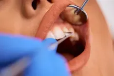 Tooth_Cracks_Why_They_Occur_and_How_They_Are_Treated