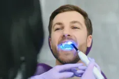 What is Teeth Polishing and How Does It Benefit Oral Health