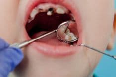 Why Do Teeth Decay and How Can We Prevent It.jpg